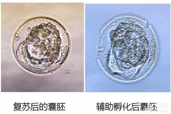 马来西亚试管婴儿医院科普：为什么胚胎冷冻多年解冻后仍可使用？